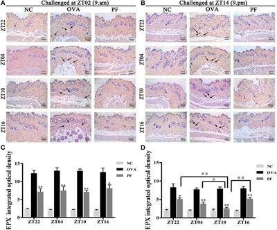 Circadian Pharmacological Effects of Paeoniflorin on Mice With Urticaria-like Lesions